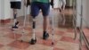 UKRAINE--Rehabilitation of the Ukrainian military, prosthetics and return to life